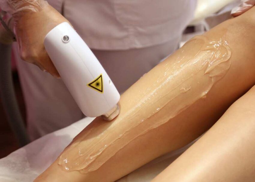 Laser Hair Removal Pro and Cons